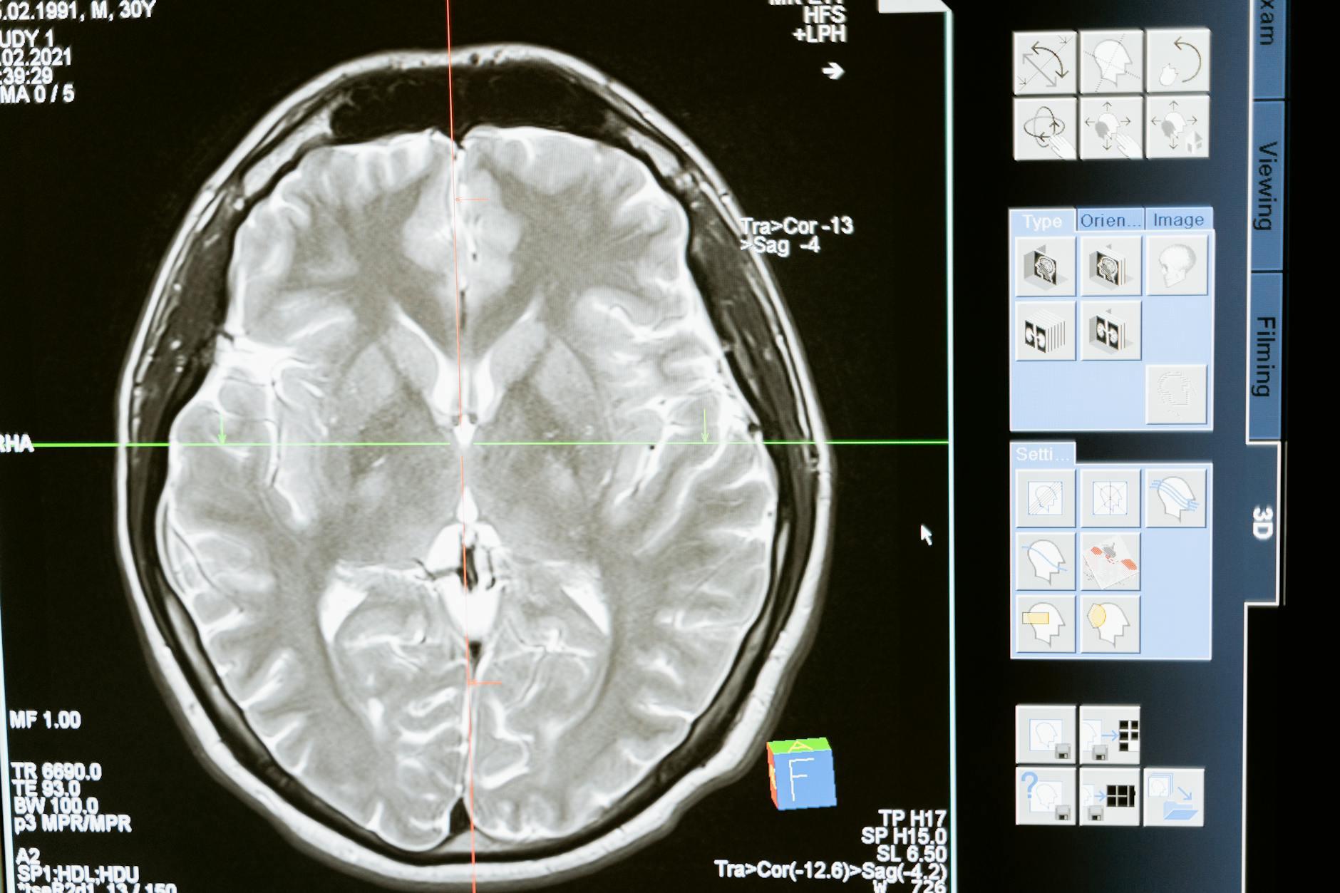4. Understanding how memories work
